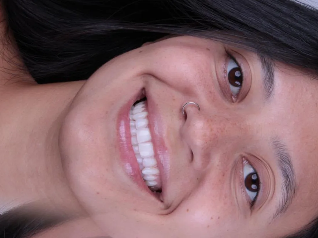 Clareamento dental, foto 1: antes do tratamento