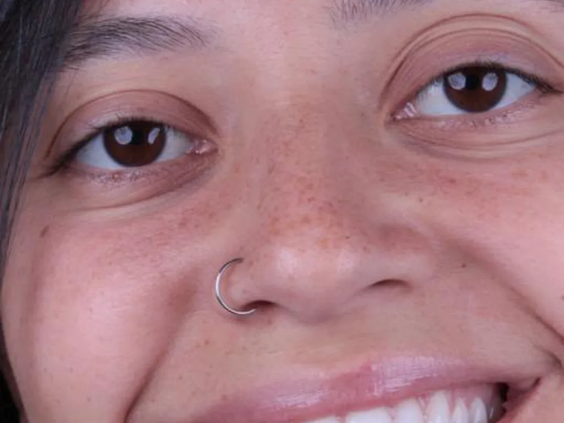 Clareamento dental, foto 2: antes do tratamento